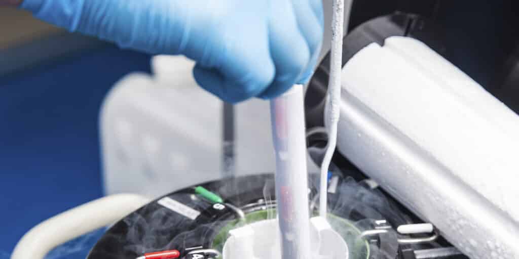 congelamento de ovulos