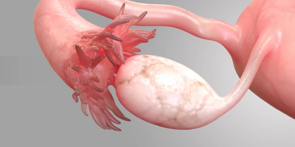 banner foliculos ovarianos