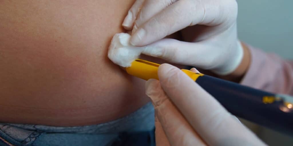 banner estimulacao ovariana