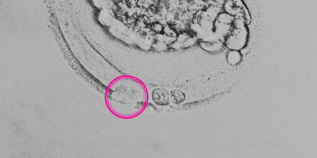 banner assisted hatching