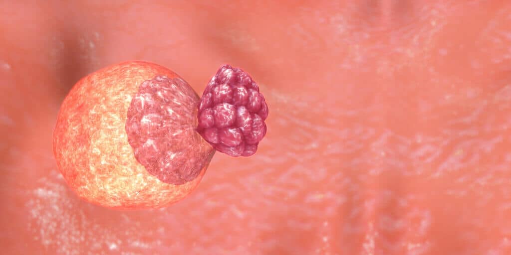 Banner como ajudar na implantação do embrião