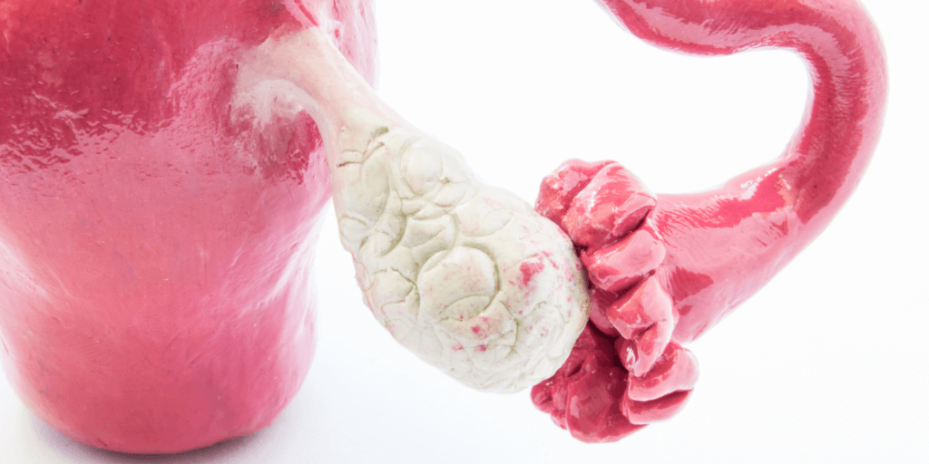 banner ovario policisticos