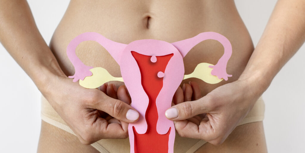 banner polipo uterino