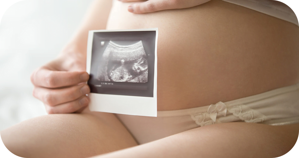 A imagem mostra uma mulher grávida segurando uma fotografia de ultrassom perto de sua barriga. Ela está usando roupas íntimas claras e está sentada, com o foco na ultrassonografia, que parece mostrar a imagem de um feto em desenvolvimento