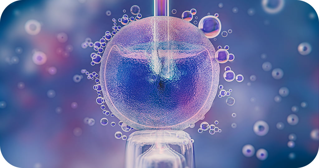 Representação artística de um processo de fertilização in vitro (FIV). No centro, há um óvulo sendo manipulado por uma micropipeta, que parece estar injetando um espermatozoide diretamente no óvulo.