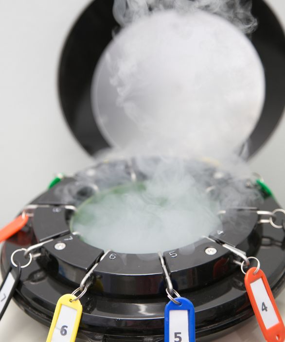 Tanque de nitrogênio líquido utilizado para criopreservação de óvulos, espermatozoides ou embriões, com vapor visível e etiquetas coloridas numeradas. Imagem relacionada à Nilo Frantz Medicina Reprodutiva.