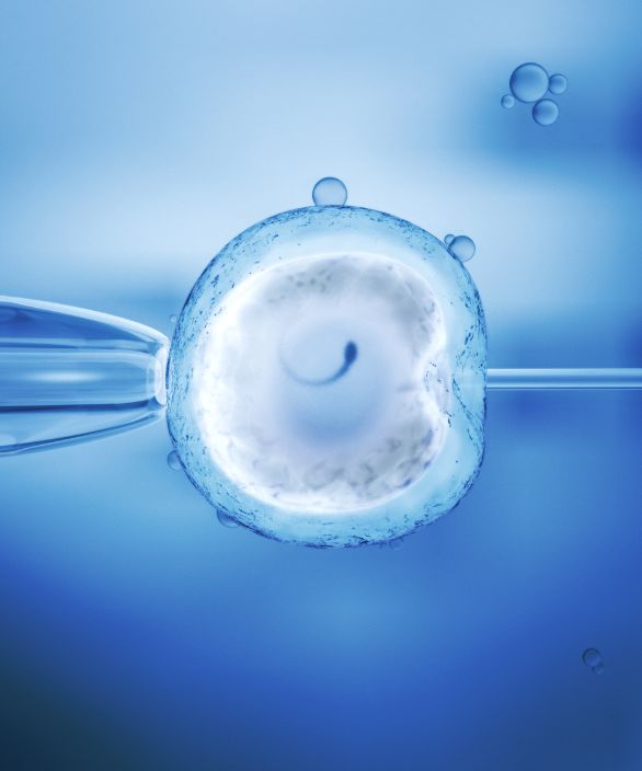 Imagem em close de uma célula reprodutiva durante o processo de fertilização in vitro (FIV), representando a introdução do espermatozoide no óvulo com auxílio de micropipeta. Representação associada à Nilo Frantz Medicina Reprodutiva.