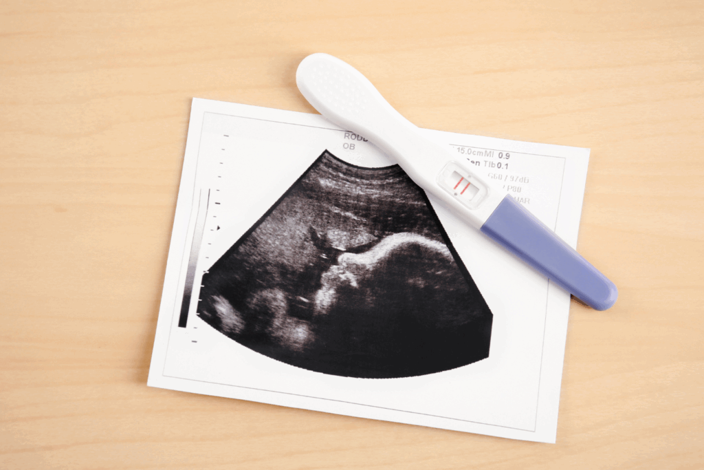 Teste de gravidez com resultado positivo sobre uma imagem de ultrassom com feto visível, representando o sucesso da FIV