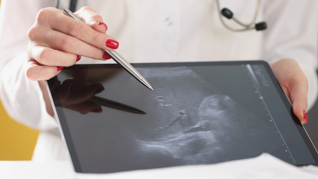 Médica analisando exame de imagem em tablet durante acompanhamento de gestação por fertilização in vitro, ilustrando a segurança do bebê e o esclarecimento de mitos sobre riscos da FIV.