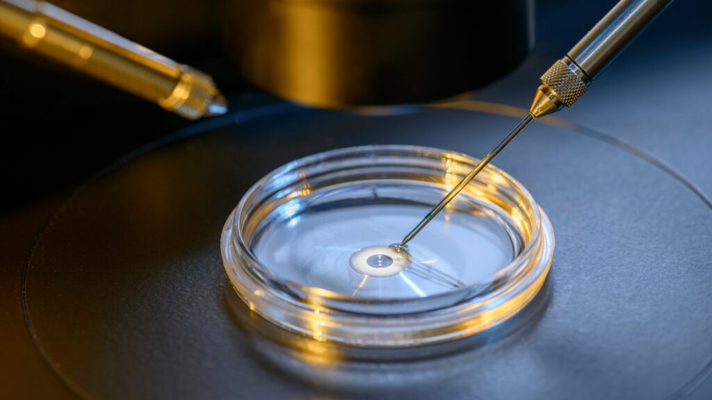 Técnica de reprodução assistida com microinjeção de espermatozoide no óvulo em laboratório, ilustrando que a tecnologia apoia o tratamento, mas não garante resultados.