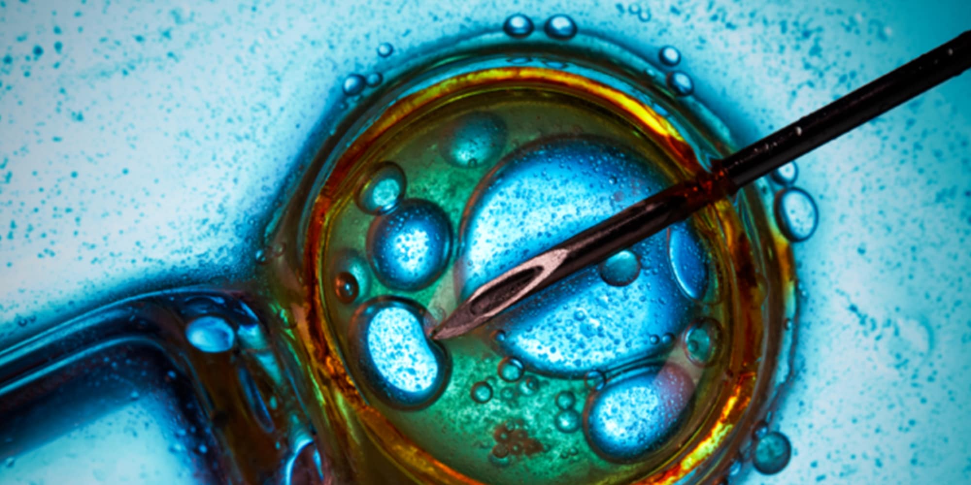 Tecnologia e a medicina reprodutiva: uma relação duradoura