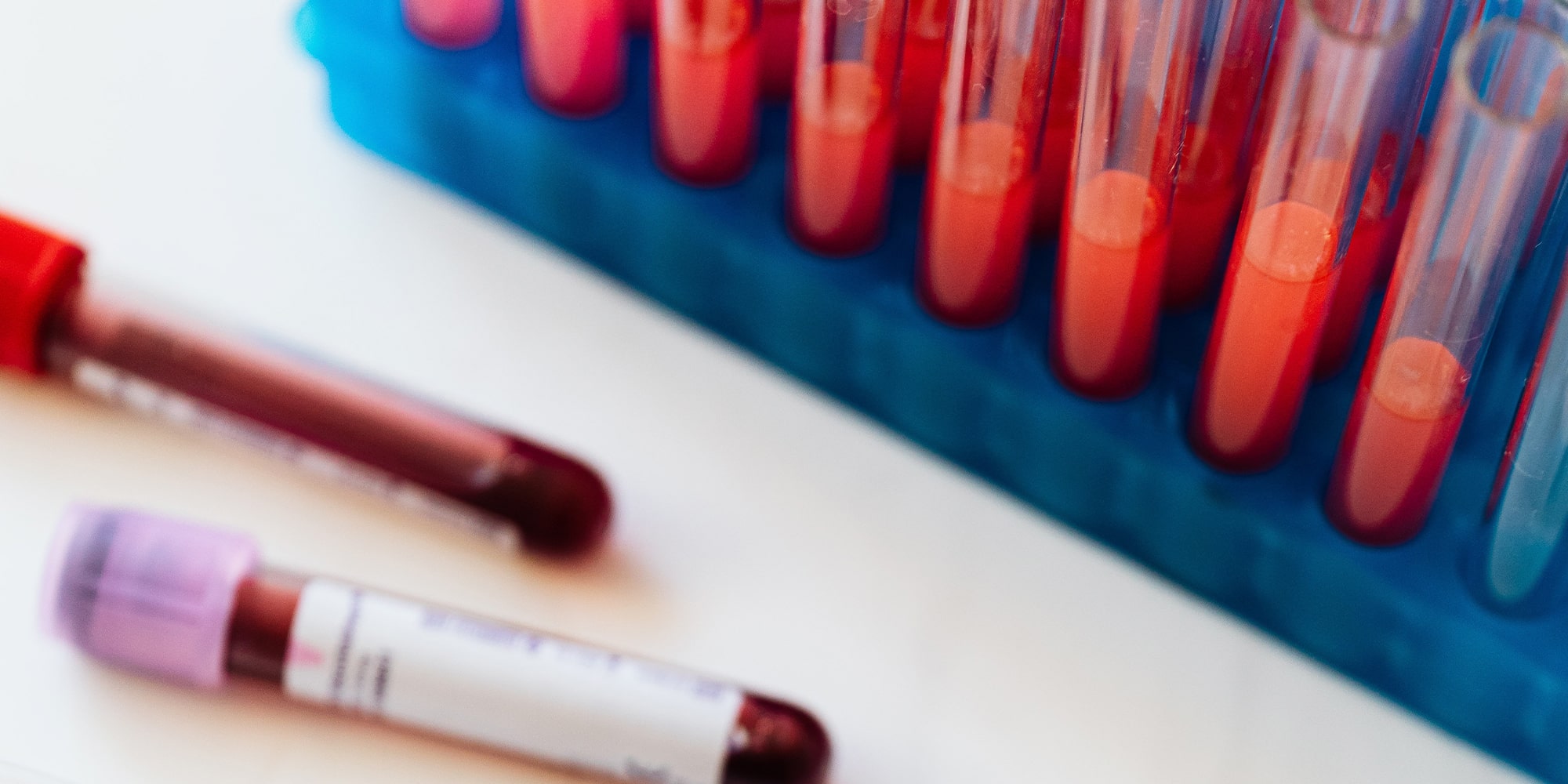 Hemofilia: o que fazer quando há histórico na família?