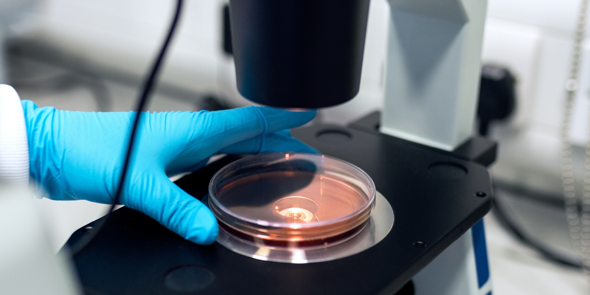 Biópsia testicular: qual sua importância para o tratamento da azoospermia?