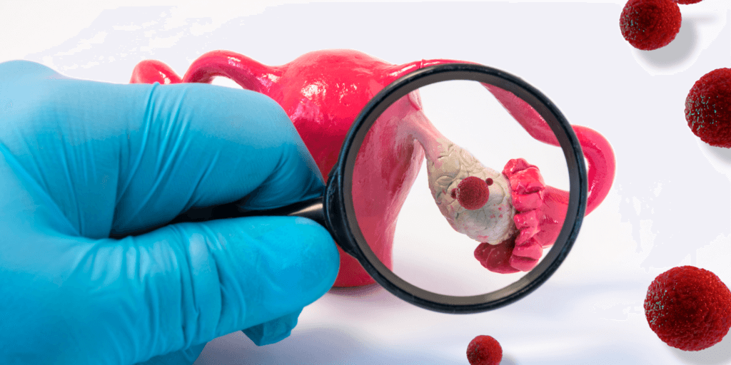 banner baixa reserva ovariana