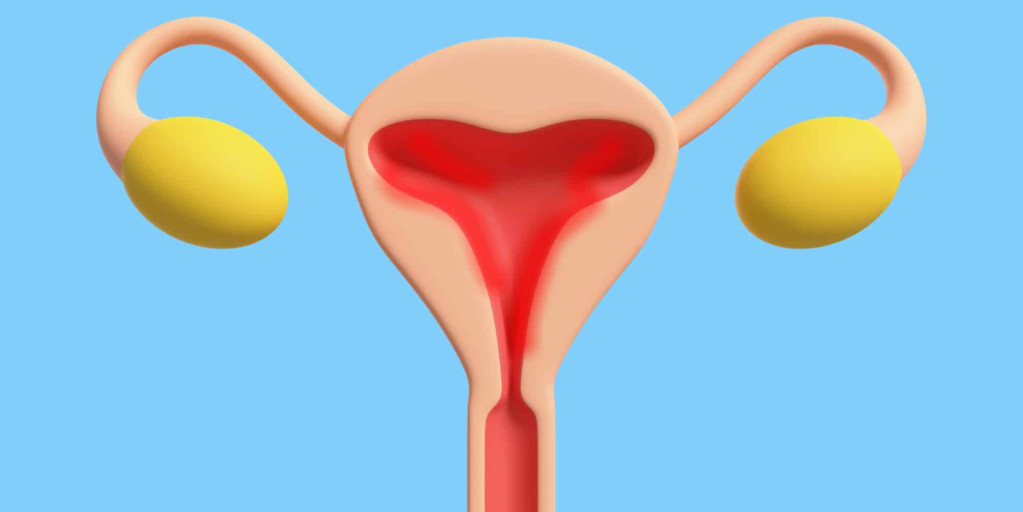 Ooforectomia e Ooforoplastia: causas e tratamentos