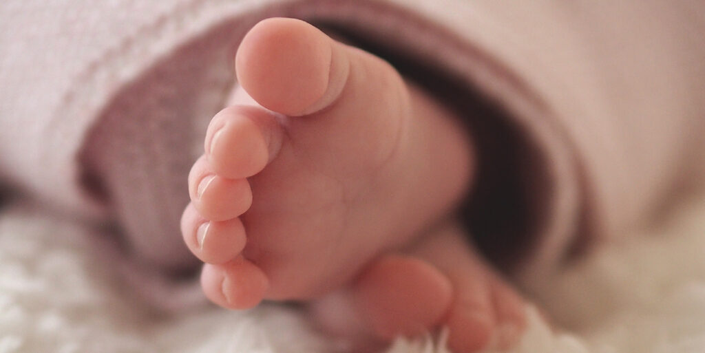 banner sindrome de turner