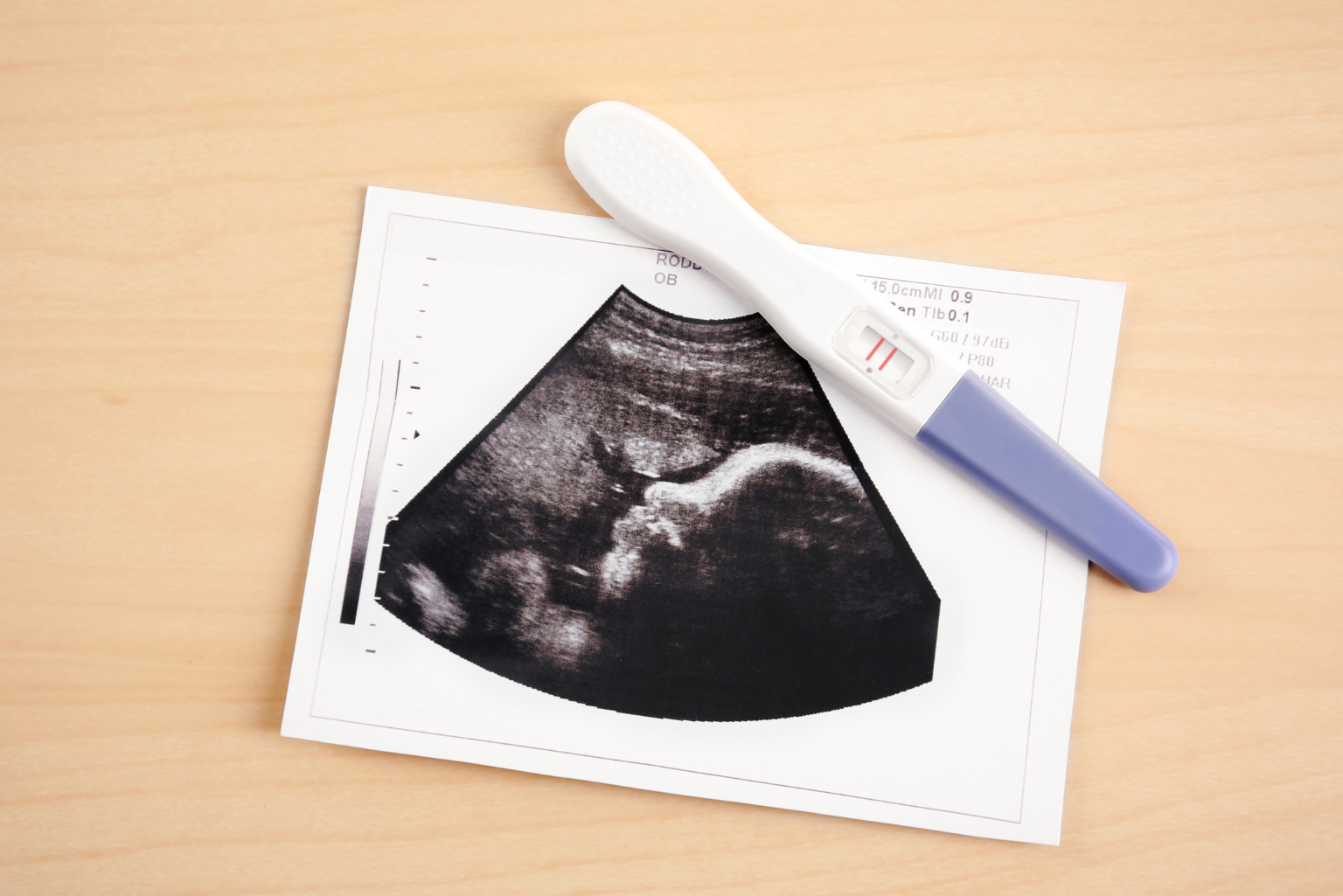 Taxas de sucesso da fertilização in vitro: como aumentá-las